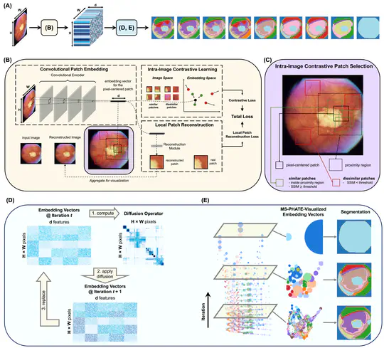 CUTS: A Framework for Multigranular Unsupervised Medical Image Segmentation