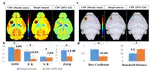 Substituting Gadolinium in Brain MRI Using DeepContrast