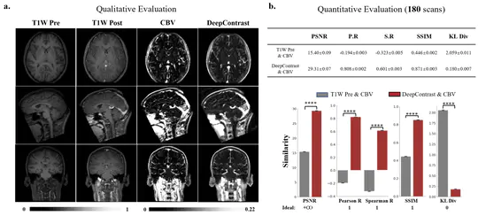 Substituting Gadolinium In Human Brain MRI Using DeepContrast