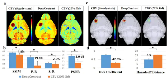 Substituting Gadolinium In Brain MRI Using DeepContrast -- A Proof-Of-Concept Study in Mice