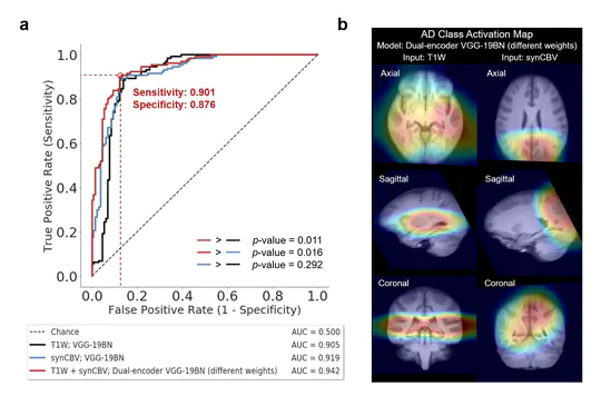 Deep Learning Identifies Neuroimaging Signatures of Alzheimer's Disease Using Structural and Synthesized Functional MRI Data