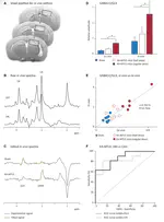 In Vivo GABA Increase as a Biomarker of the Epileptogenic Zone: an Unbiased Metabolomics Approach