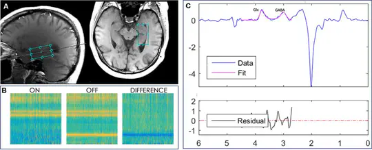 Reduced Hippocampal GABA is associated with Poorer Episodic Memory in Healthy Older Women: A Pilot Study