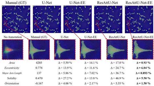 Segmentation with Residual Attention U-Net and an Edge-Enhancement Approach Preserves Cell Shape Features